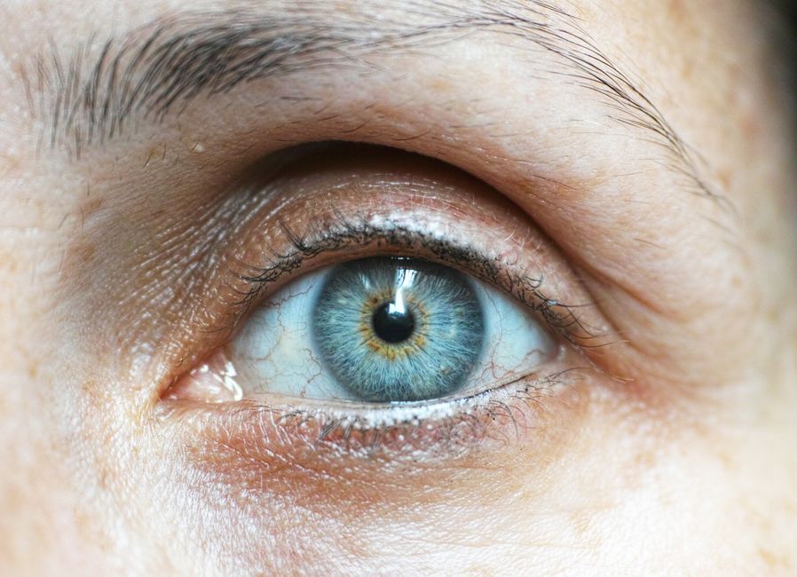 Vision Correction